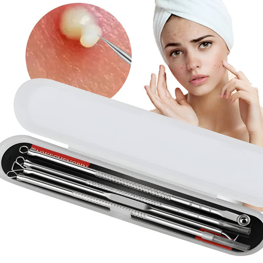 Acne blackhead removal tweezers