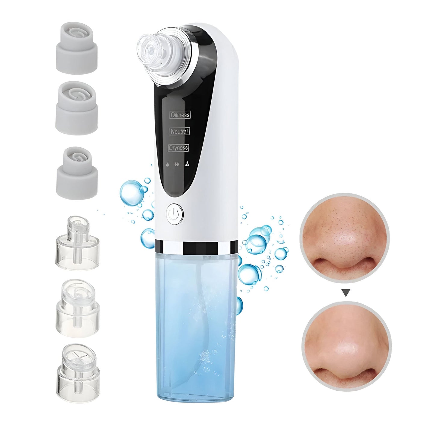 Face Blackhead Remover Cleaner Vacuum