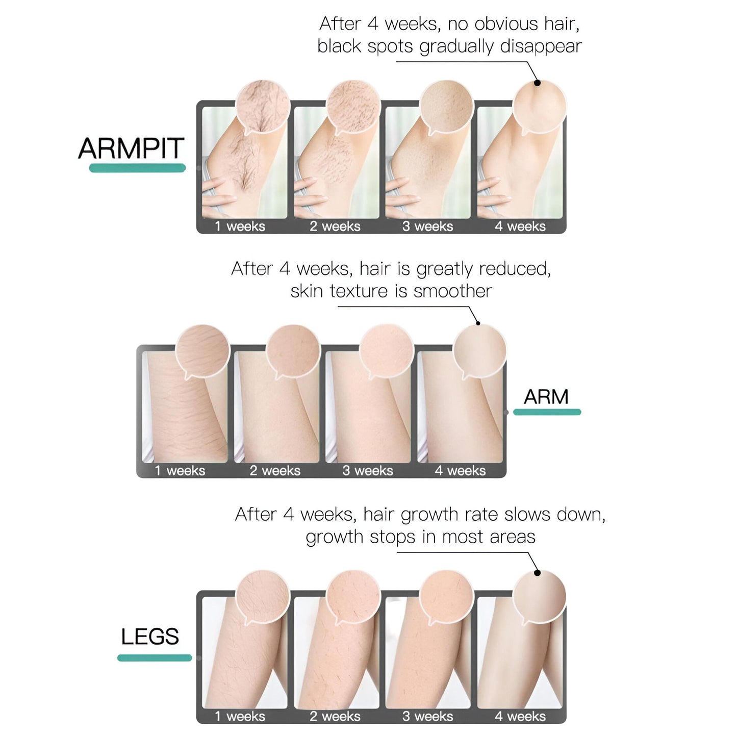 Laser Hair Removal Pro | Whole Body