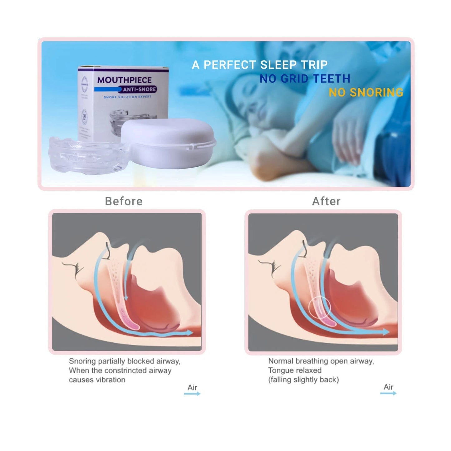 Portable Mouthpiece Anti-Snore with Protective Storage Case