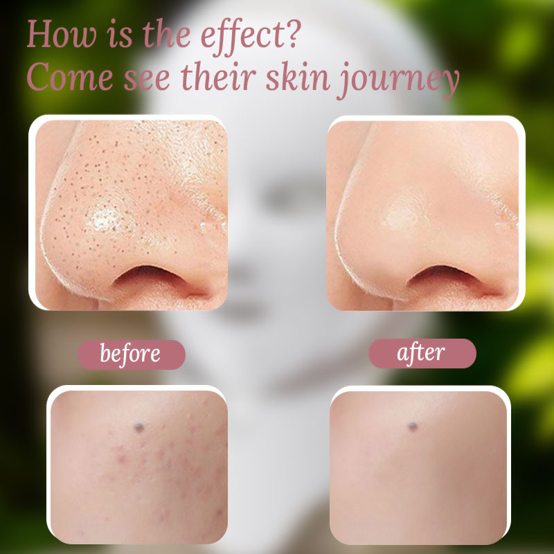 7-Color LED Facial Mask for Skin Rejuvenation - beautyessence beautyessence LED Light Therapy Mask