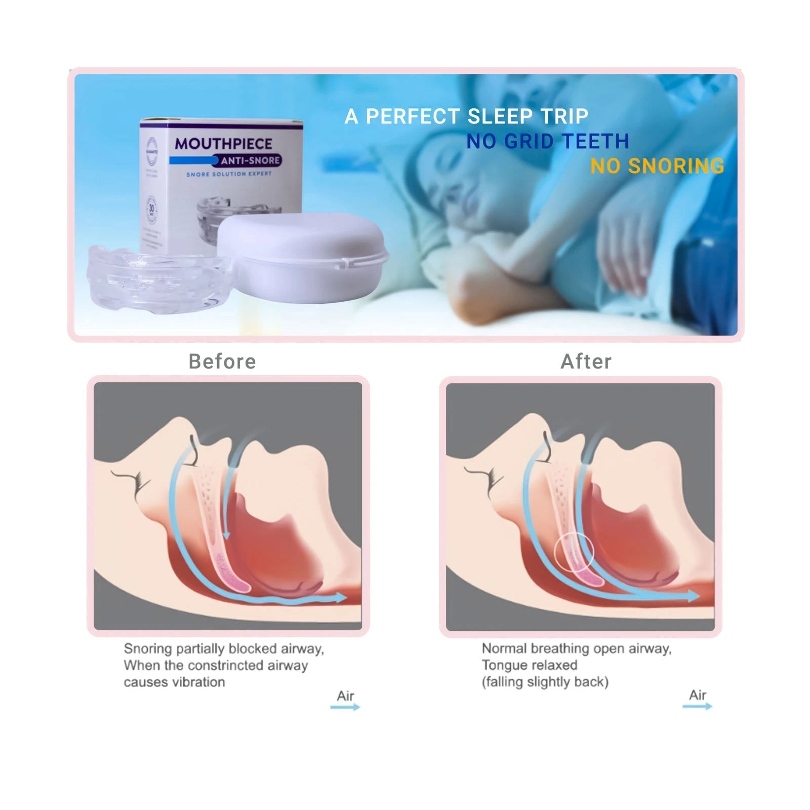 Portable Mouthpiece Anti-Snore with Protective Storage Case
